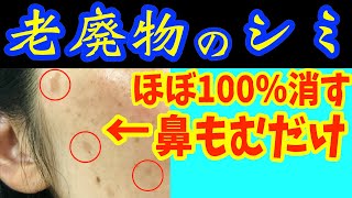 寝る前に騙されたと思ってシミ消し‼鼻をつまむだけでほうれい線、ゴルゴライン、白髪をなくす方法で垢抜け！目の下・顔のたるみも解消しガチガチ首コリまで一瞬で楽になるスキンケア【ダイエット整体師】 [upl. by Oirotciv]