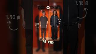 8 cm with Precice 2 method limblengthening motivation changeyourlife transformation shorts [upl. by Darius]