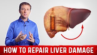 How To Repair Liver Damage After Alcohol – DrBerg on Liver Cirrhosis [upl. by Janine]