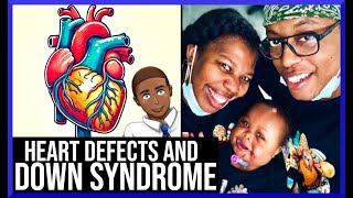 Managing Congenital Heart Defects in Down Syndrome Kids [upl. by Sherrie820]