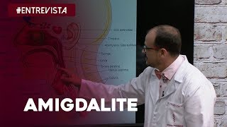 Saiba mais sobre Amigdalite [upl. by Attener]