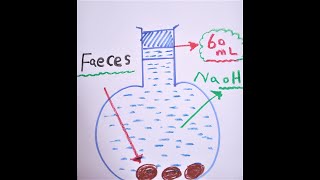 Stolls technique demonstration by Dr Marwa Omar [upl. by Eicart45]