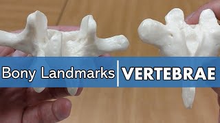 Bony Landmarks of the Vertebrae [upl. by Nadler946]