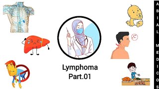 Lymphoma  Hodgkins lymphoma  Sign and symptoms  Diagnosis  Treatment [upl. by Belsky]