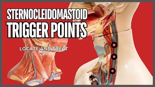 Understanding Trigger Points in the Sternocleidomastoid Muscle [upl. by Kayle]