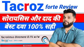 Tacroz Forte Ointment Review  Tacrolimus Ointment Uses Mode Of Action amp Side Effects In Hindi [upl. by Malcom]