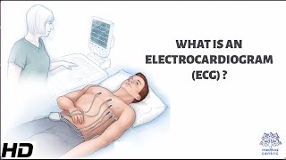 What Is An Electrocardiogram [upl. by Elo]