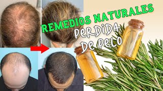 Remedios naturales y caseros para la perdida de pelo🌿 [upl. by Anawik798]