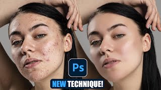 New Photoshop Trick Perfect Skin in Minutes – Acne Gone Smooth Skin with Simple Steps [upl. by Satsok]