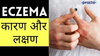 Eczema एक्जिमा Causes Symptoms amp Types  Atopic amp Seborrheic Dermatitis Symptoms Hindi Practo [upl. by Amliw]