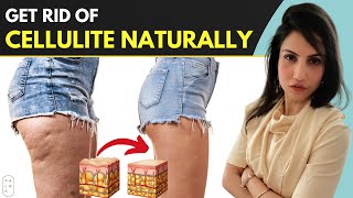 How To Get Rid Of Cellulite Naturally  जमी हुई चर्बी हटाये [upl. by Sucramel220]