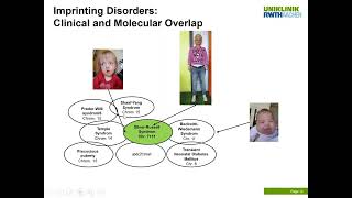 Molecular diagnostic testing of imprinting disorders and related growth disturbances [upl. by Ahsaret470]