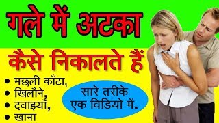 गले में अटका हुआ कैसे निकालें  मछली काँटा गले से कैसे निकालें  what to do if someone is choking [upl. by Aihsekin]