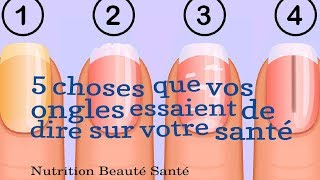 5 choses que vos ongles essaient de dire sur votre santé [upl. by Nataline618]