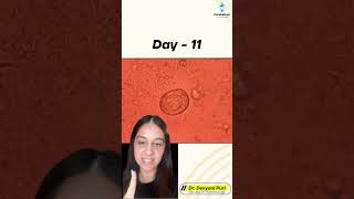 Welcome to today’s Micro Mystery  Can you crack this case  Day 11  Dr Devyani Puri [upl. by Namijneb]