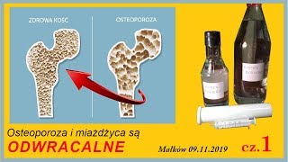 OSTEOPOROZA I MIAŻDŻYCA  TO JEST ODWRACALNE Małków 09112019 cz1 [upl. by Ayahsal]