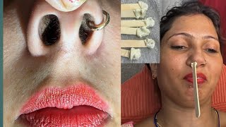 Nose hair waxingpiggynose nosepulling pummybeautyparlour pummybeautyworld [upl. by Bozovich]