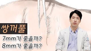 수험생 이벤트로 쌍수하는 분이 꼭 봐야하는 영상 [upl. by Savina]