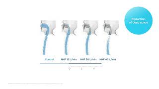 How does Optiflow High Flow work Mechanisms of action – Reduction of dead space no audio [upl. by Yelrihs]