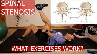 BEST EXERCISES FOR SPINAL STENOSIS [upl. by Tnert]