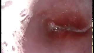 Reflux esophagitis in dog wwwendovetsu Russia  Kurgan [upl. by Enneillij663]