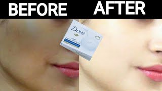 Dove soap for skin whitening cream  Dove white beauty Bar whitens skin  Skin whitening remedies [upl. by Alaekim]