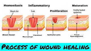 Process of Wound Healing  Wound Healing Process  Nursing Sagar [upl. by Eadmund304]