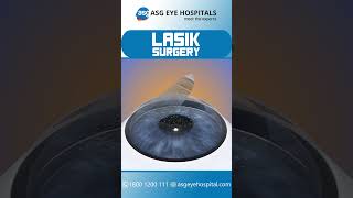 Experienc enhanced vision with lasik surgery at asg eye hospital  Eye Care Services  Eye Hospital [upl. by Ecirtnuahs]