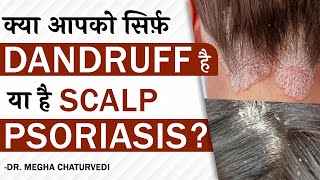 क्या है Seborrheic Dermatitis और Scalp Psoriasis में अंतर   Dry Scalp vs Dandruff  Dr Health [upl. by Brainard]