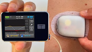 Omnipod 5 vs Tandem tslim x2  Full Test amp Review [upl. by Moia]