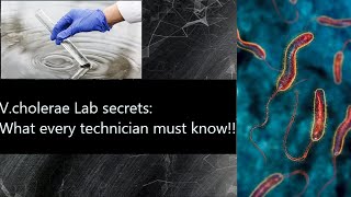 cholera Uncovered Must watch for norcet labtechnician vibrio microbiology bacteriology mlt [upl. by Fiore878]