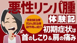 【悪性リンパ腫ホジキンリンパ腫stageⅡB】しこりを発見したら要注意！放っておかず検査を！ [upl. by Roleat]