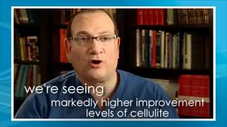 Cellulaze Testimonials [upl. by Hartmann551]