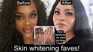 Skin Whitening Regimen How I lightened My Dark Knuckles Fast [upl. by Kin151]