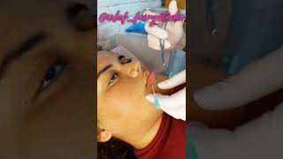 🧚🏻‍♀️ LATERAL LABRET piercing bodypiercer inkoffairystudio [upl. by Ainuj]