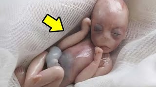 🛑The stillborn baby left everyone shocked😱 [upl. by Sallyann102]