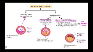 IM Cardiology 2 Ischemic Heart Disease IHD Introduction [upl. by Shewmaker]