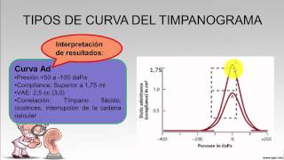 ¿Qué es una impedanciometría Examen de impedanciometría [upl. by Vish241]