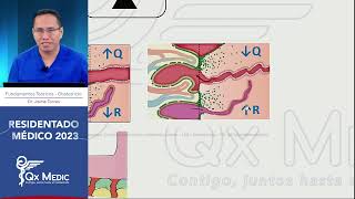 Obstetricia  5 Estados Hipertensivos [upl. by Haikezeh]