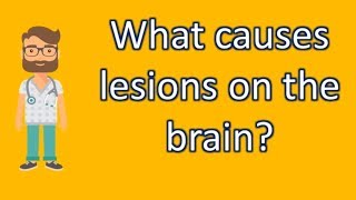 What causes lesions on the brain   Top Health FAQ Channel [upl. by Lawton]