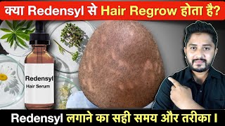 क्या Redensyl से Hair Regrow होता है Redensyl Serum for Hair Growth [upl. by Hairu]