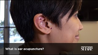 What Is Ear Acupuncture [upl. by Andert192]