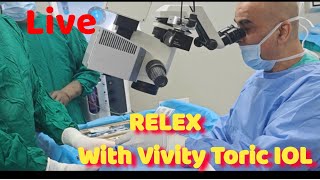 Live RELEX with Vivity Toric IOL in a Myopic Eye Dr Kamal Kapoor [upl. by Mellisa]