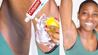 HOW TO LIGHTEN DARK UNDERARMS NATURALLY amp FAST WITH COLGATE TOOTHPASTE amp LEMON [upl. by Aicylla285]