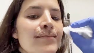 Pro Skater Brooklinn Khoury Shares Lip Reconstruction Progress 3 Years After Dog Attack [upl. by Lienhard39]