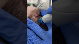 Get a Deep Scalp Facial with Keravive by Hydrafacial  Dr MediSpa [upl. by Nesyaj]