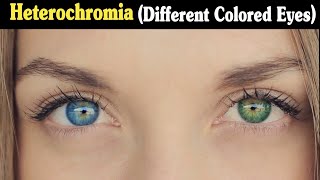 What is Heterochromia  Different Colored Eyes UrduHindi [upl. by Yellek77]