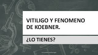 Vitiligo y Fenómeno koebner ¿Lo tienes [upl. by Mientao]