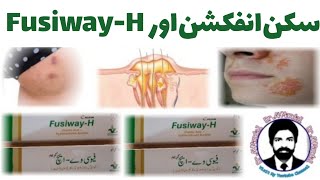 FusiwayH Cream  FusiwayH Best in Skin Infection  DrAHMandal Urdu  Hindi [upl. by Dyol901]