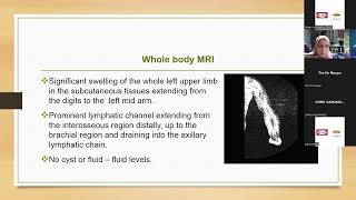 Primary Intestinal Lymphangiectasia  The treatment update Dr E Losta [upl. by Lemaj158]